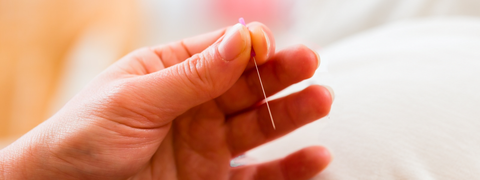 An acupuncturist is performing acupuncture on a pregnant woman