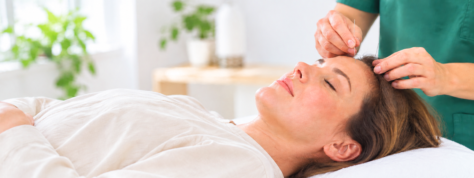 An acupuncturist is performing acupuncture on a young woman’s head